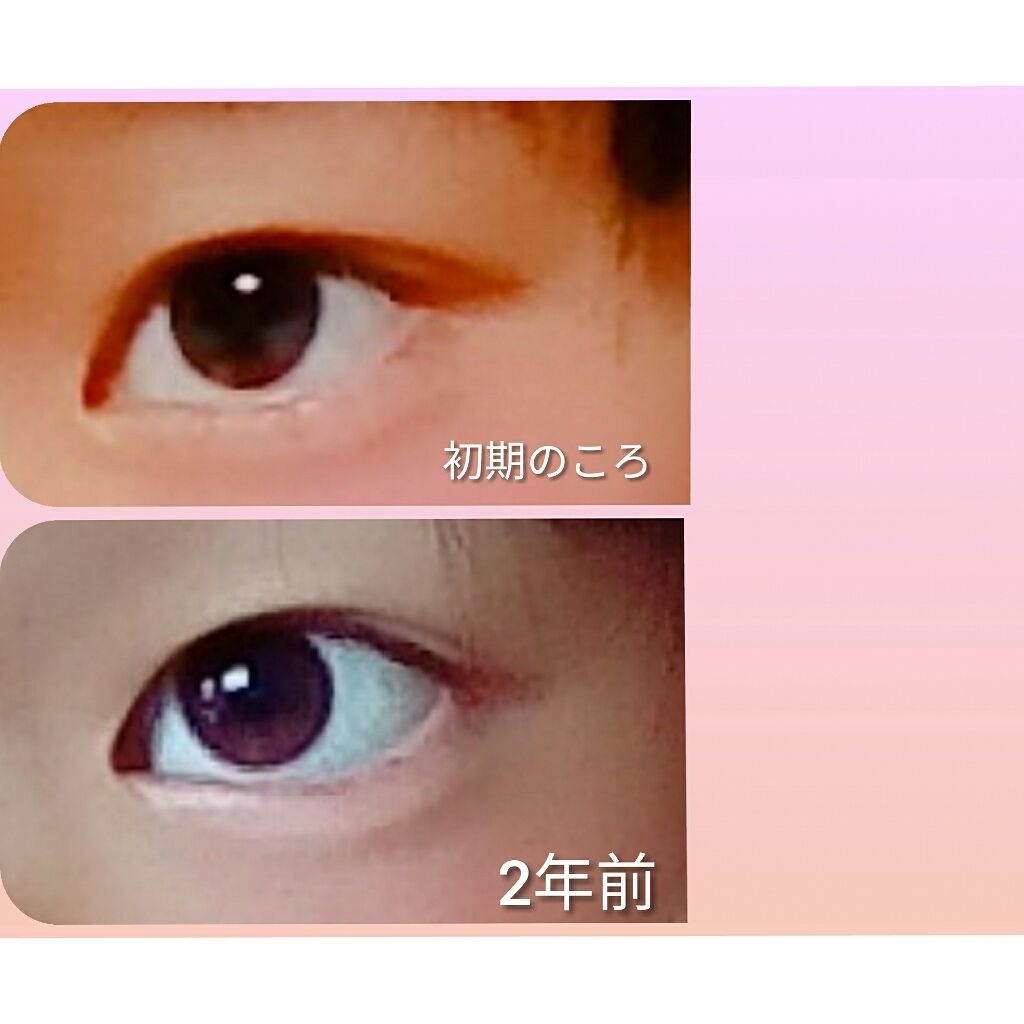 のび〜る アイテープ 両面テープタイプ/DAISO/二重まぶた用アイテムを使ったクチコミ(2枚目)