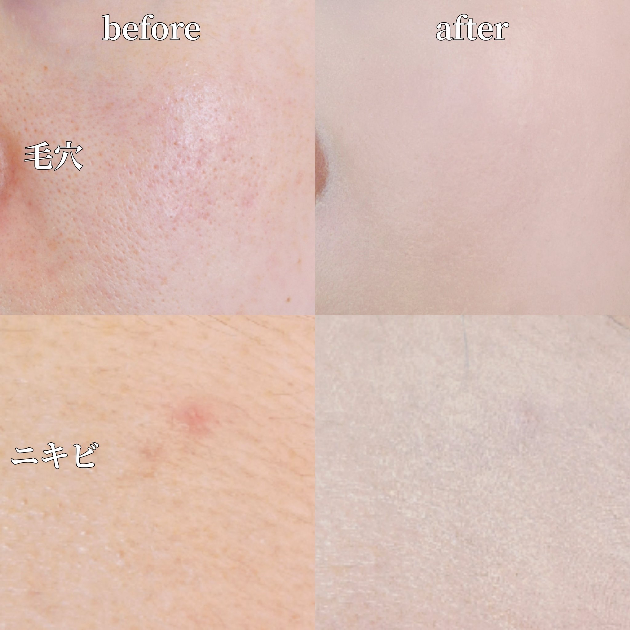 カバーアッププロコンシーラー/TFIT/パレットコンシーラーを使ったクチコミ（2枚目）