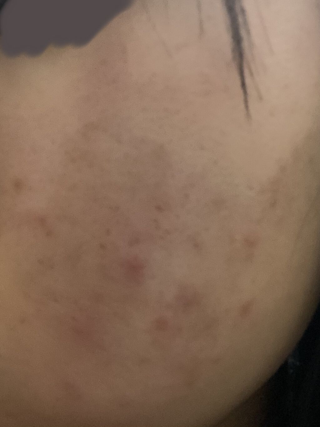 明色美顔水 薬用化粧水/美顔/化粧水を使ったクチコミ（3枚目）