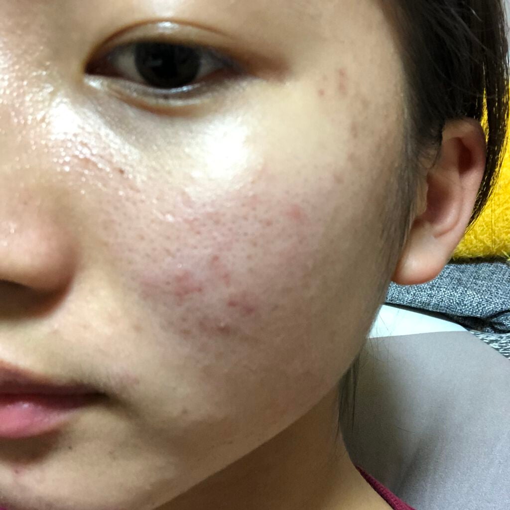 明色美顔水 薬用化粧水/美顔/化粧水を使ったクチコミ(1枚目)