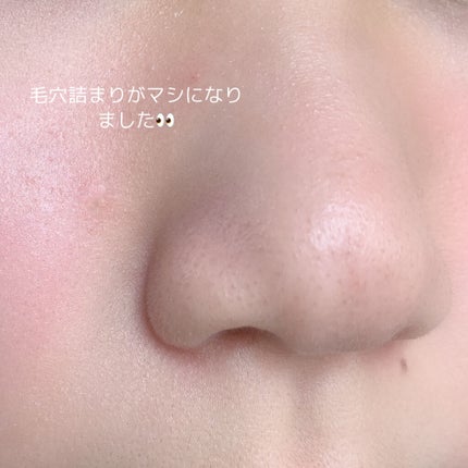 スーパー毛穴ピールセラム/ラボラボ/美容液を使ったクチコミ(5枚目)