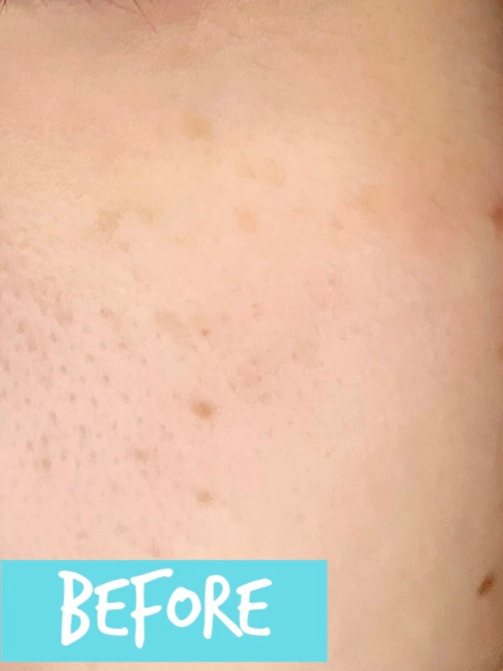 ビタミントーニングシミセラム/BIOHEAL BOH/美容液を使ったクチコミ(2枚目)