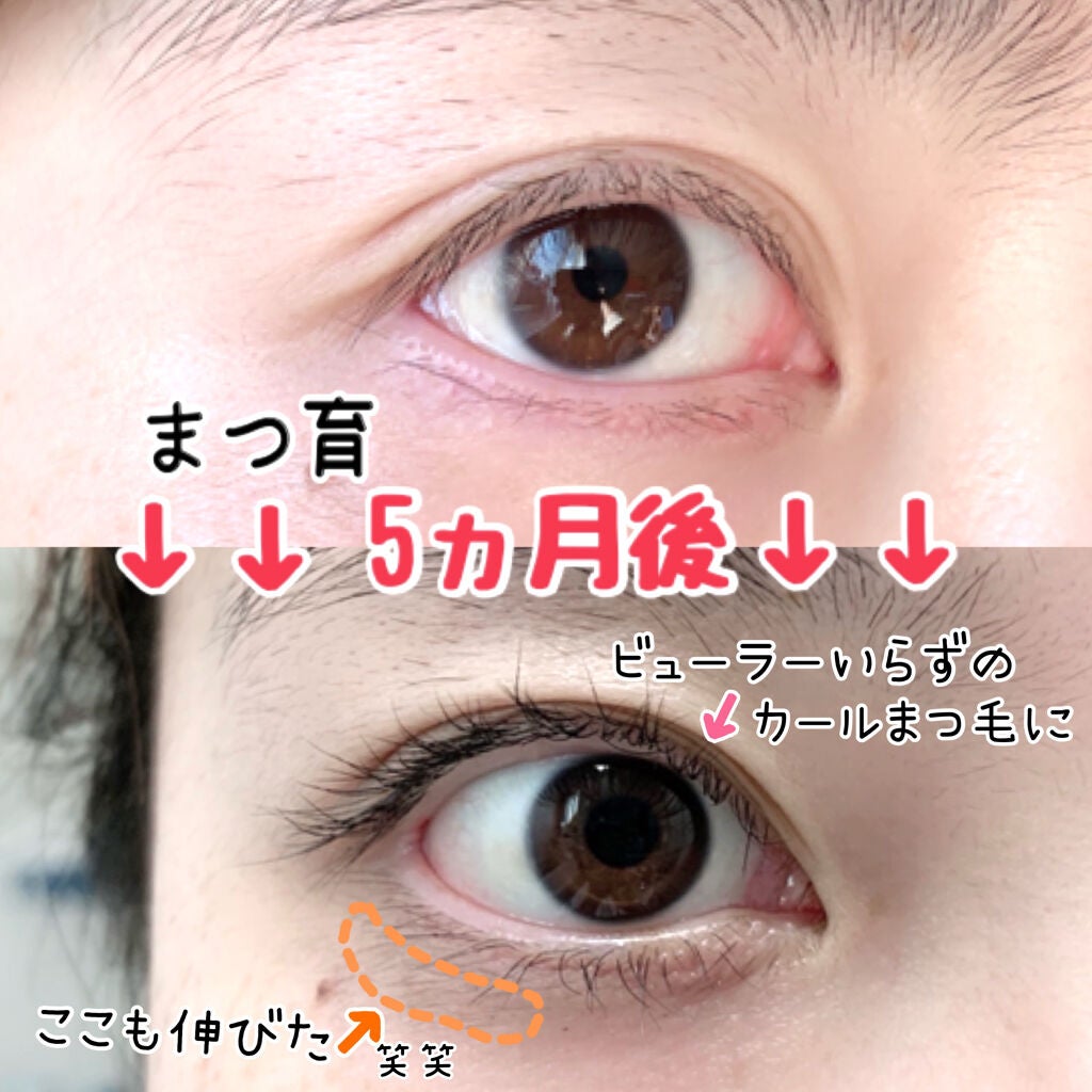 EMAKED(エマーキット)/水橋保寿堂製薬/まつげ美容液を使ったクチコミ(2枚目)