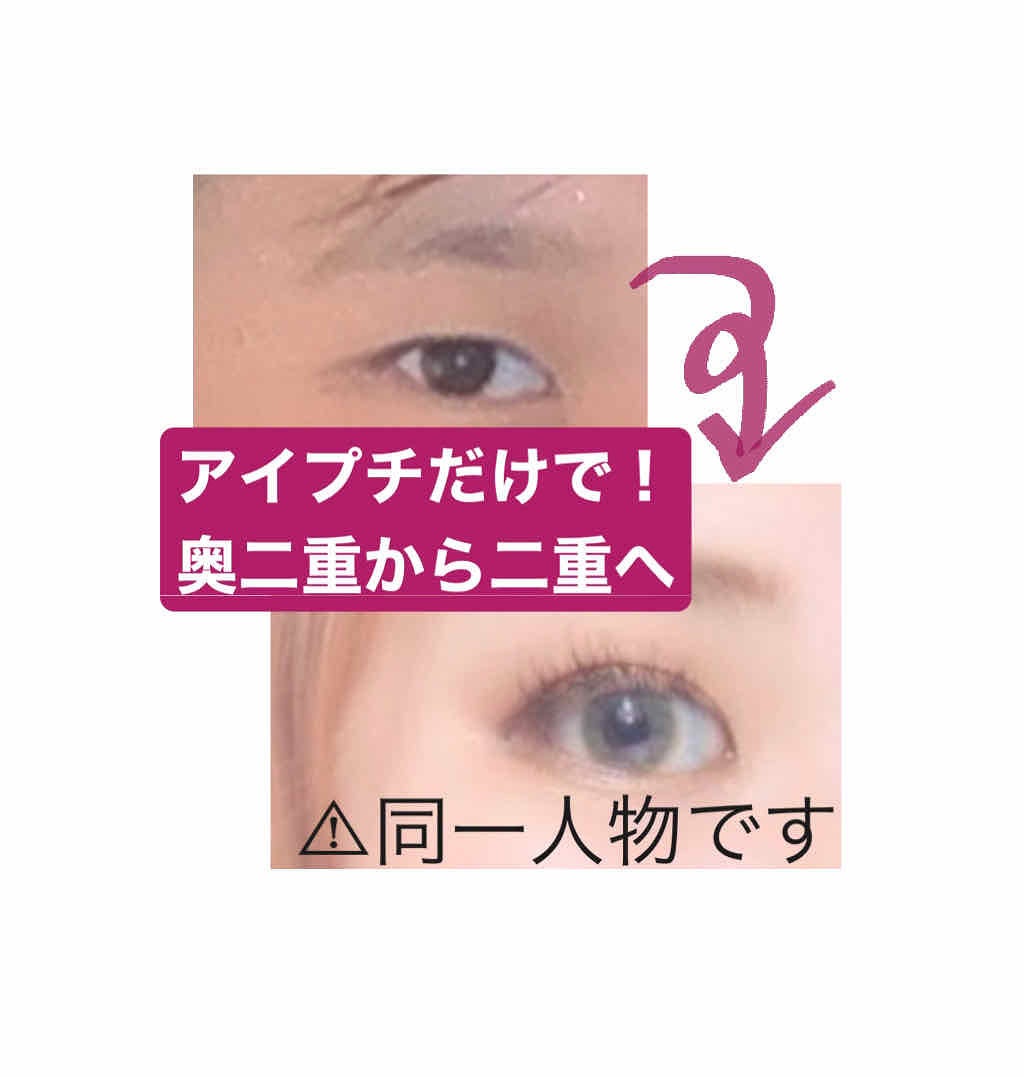 アイテープ 埋没式両面テープ/DAISO/二重まぶた用アイテムを使ったクチコミ(1枚目)