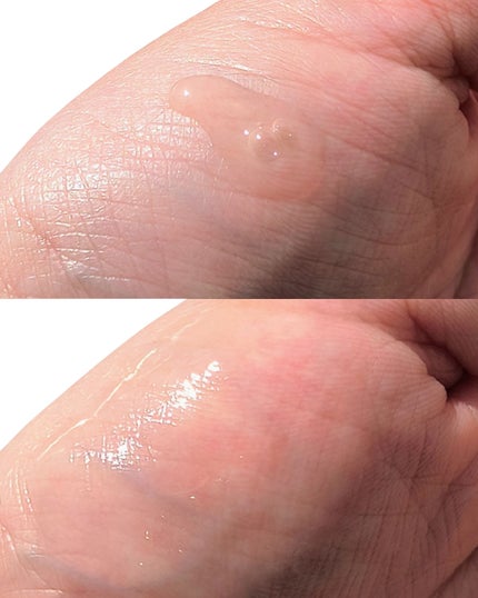 RXザ・アルファアルブチン2 ニキビ跡ケアセラム/COSRX/美容液を使ったクチコミ(4枚目)