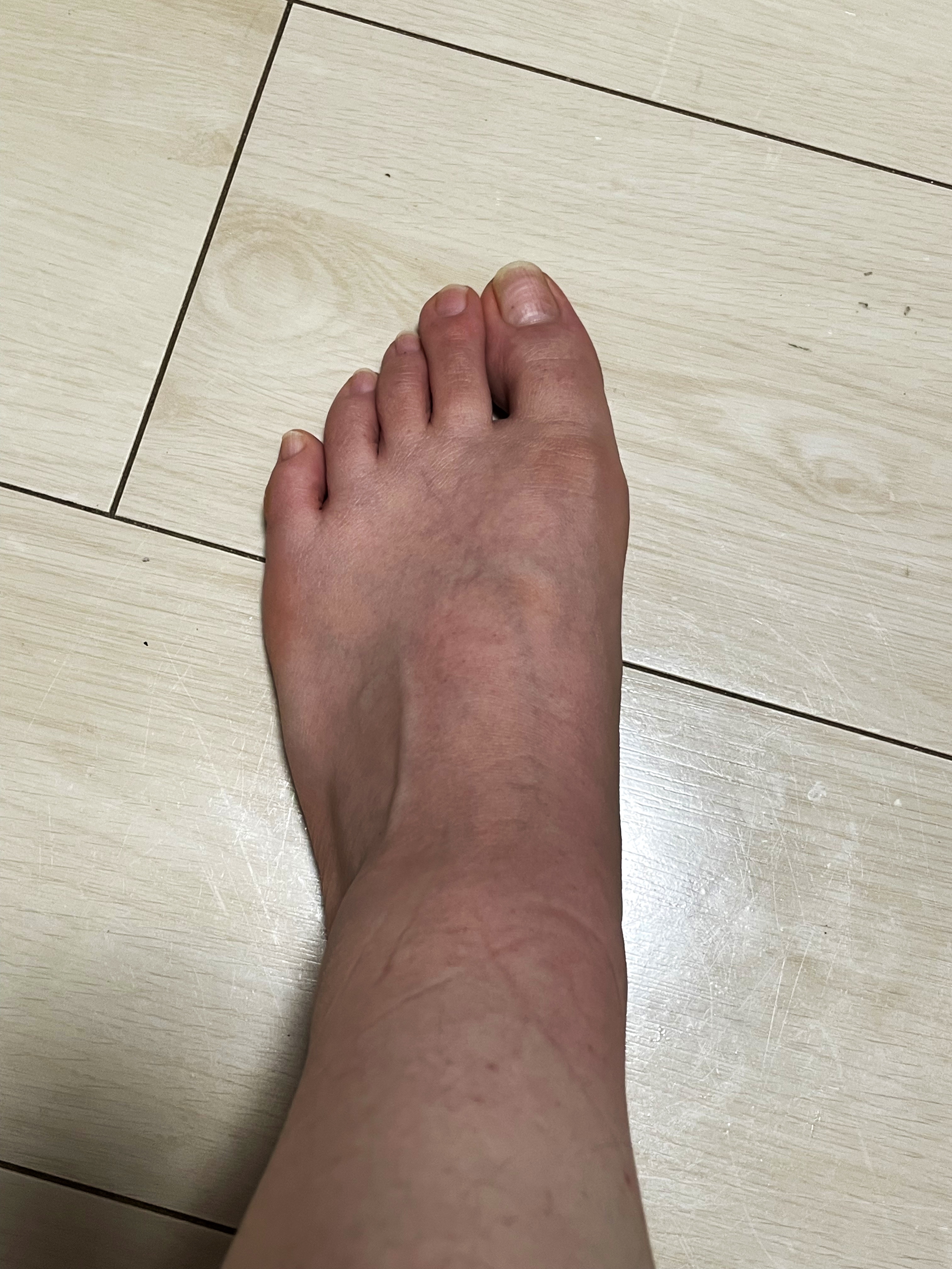 イージーパックDP60分タイプ 60分タイプ Sサイズ/ベビーフット/レッグ・フットケアを使ったクチコミ（2枚目）