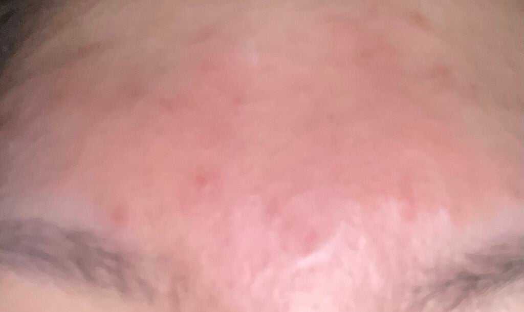 潤浸保湿 フェイスクリーム/キュレル/フェイスクリームを使ったクチコミ(3枚目)