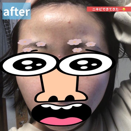 メルライン/リアルビューティーケア/オールインワン化粧品を使ったクチコミ(6枚目)