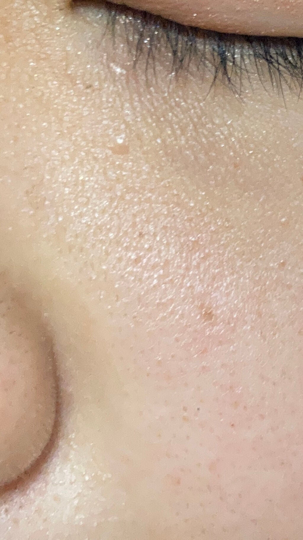 twinkle_rouge_xl17 on LIPS 「閲覧注意です(?)写真のような細かいポツポツが気になりますどう..」(2枚目)