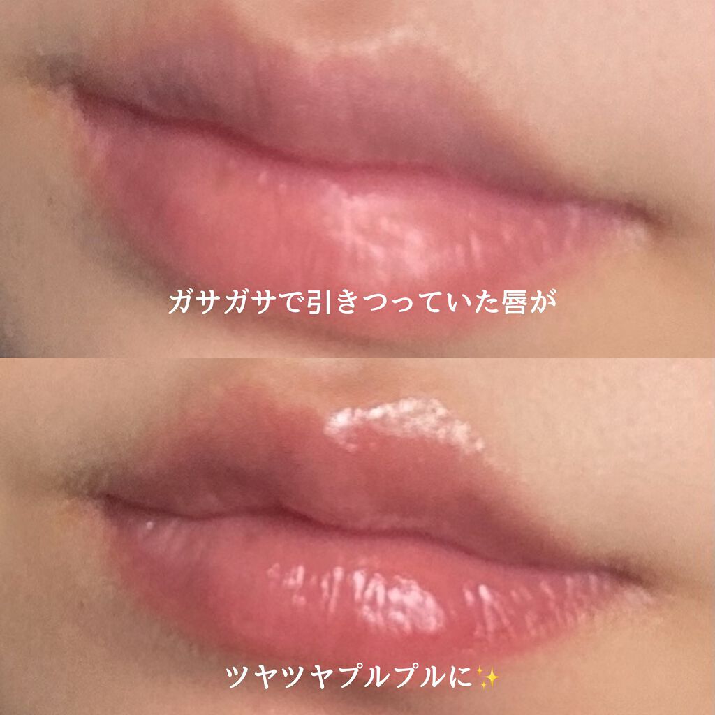 モアリップ N (医薬品)/資生堂薬品/その他を使ったクチコミ(2枚目)