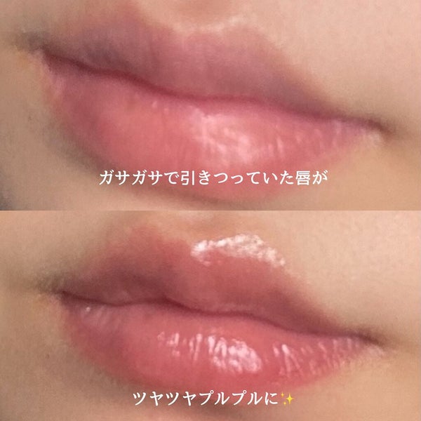 モアリップ N (医薬品)/資生堂薬品/その他 by まるのすけ