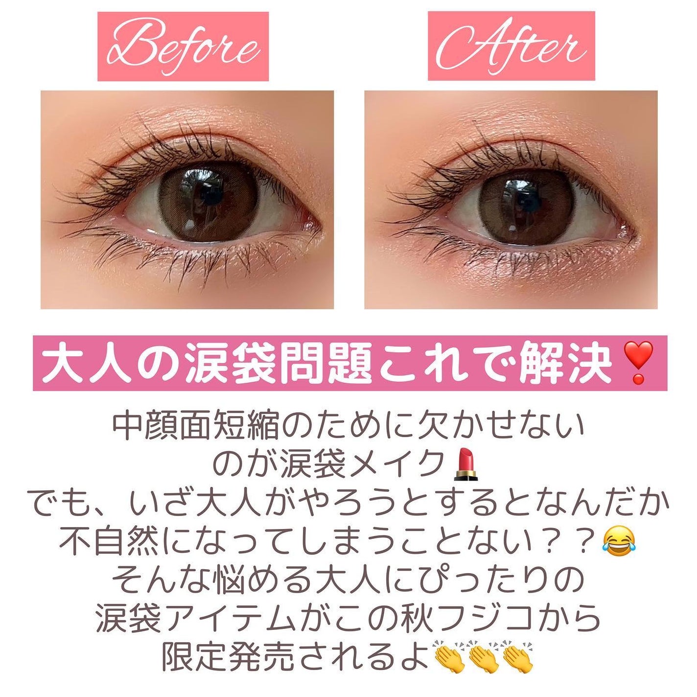 涙袋ベイビー/Fujiko/スティックアイシャドウを使ったクチコミ(2枚目)