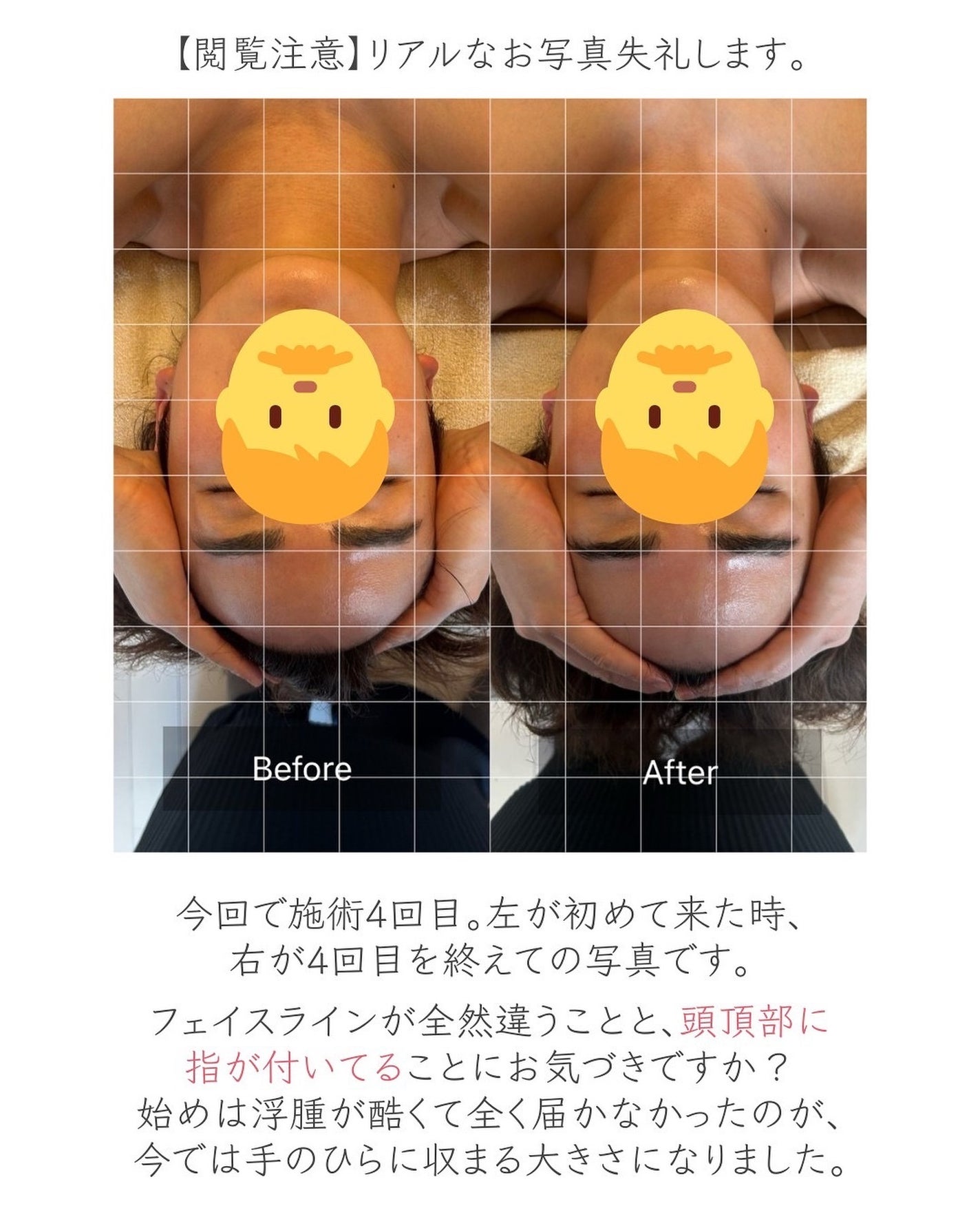 ヒロキ|40歳の美容家 ヘアケア スキンケア on LIPS 「以前も投稿しましたが、銀座のドライヘッドスパ専門店SAWAEで..」(4枚目)