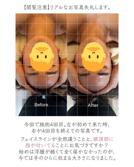 ヒロキ|40歳の美容家 ヘアケア スキンケア on LIPS 「以前も投稿しましたが、銀座のドライヘッドスパ専門店SAWAEで..」(4枚目)