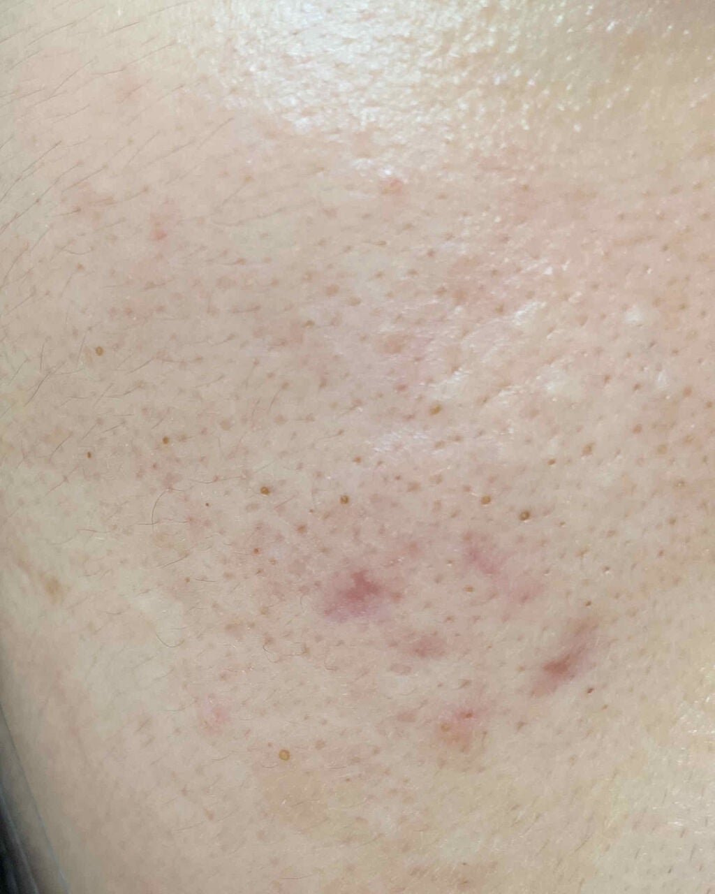 マシュマロメンタル on LIPS 「⚠️2枚目汚肌とおります⚠️閲覧ありがとうございナマステ🤲🏻こ..」(2枚目)