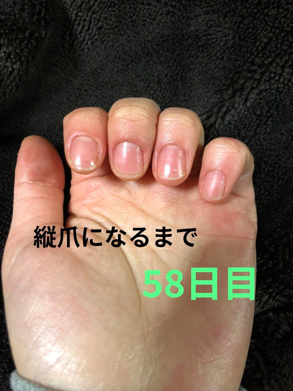 ð on LIPS ã瞊çªã«ãªãããã«ãããããªæ¹æ³ããã£ããæããŠãã ããðã¡ãªã¿..ãïŒ1æç®ïŒ