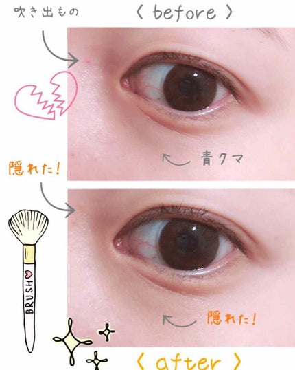 サイレントカバー コンシーラー/excel/パレットコンシーラーを使ったクチコミ(3枚目)