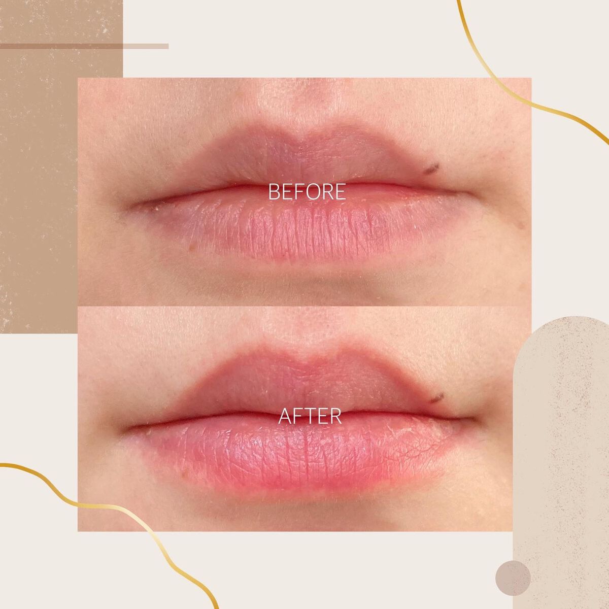 リップスクラブ/sara happ(サラハップ)/リップスクラブを使ったクチコミ(1枚目)