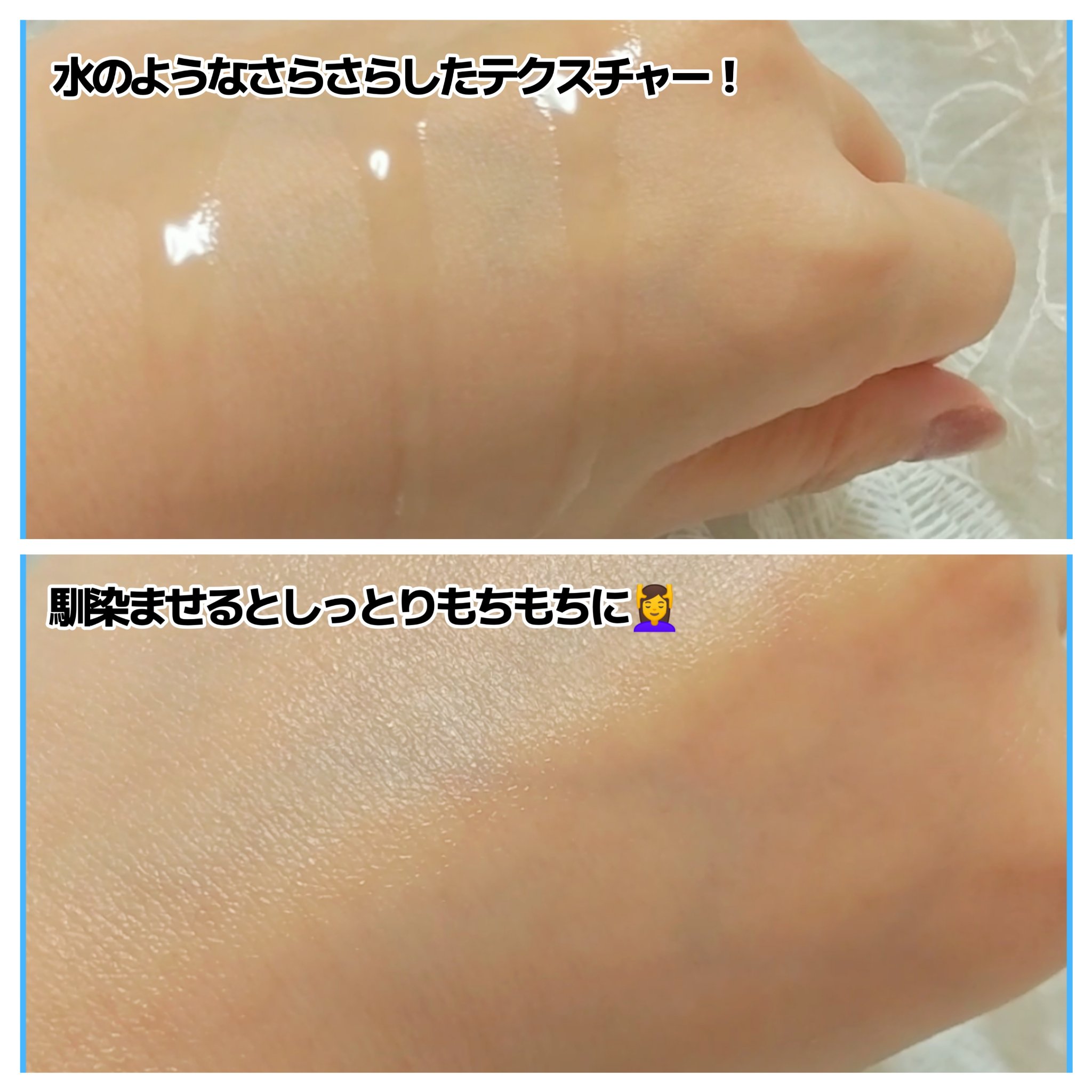 シラカバ 70% 水分ブースティングトナー/Anua/化粧水を使ったクチコミ（3枚目）