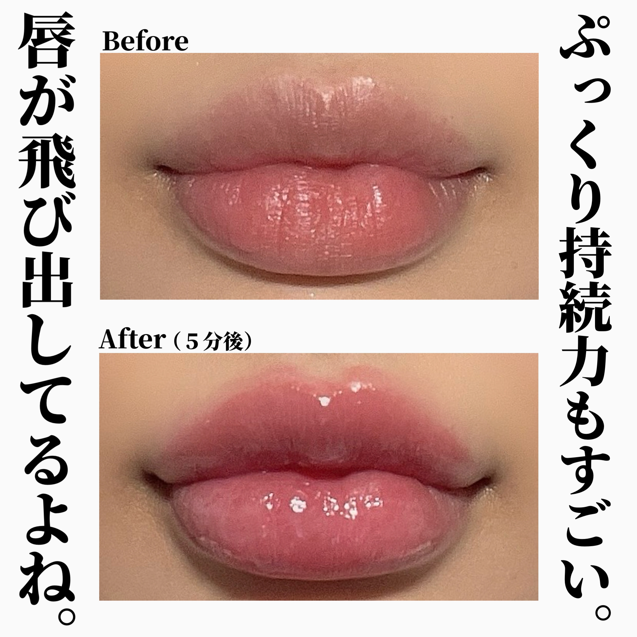 リードルS リッププランパーエキスパート/VT/リッププランパーを使ったクチコミ（3枚目）