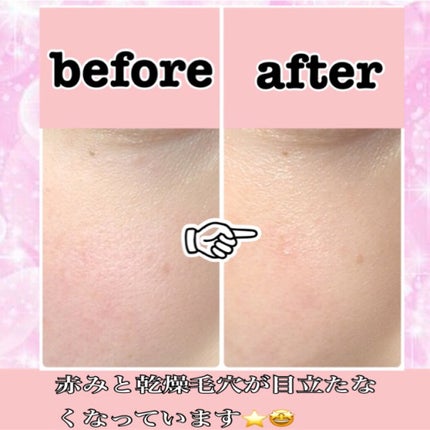 ビタ ジェニックゼリーマスク/BANOBAGI/シートマスク・パックを使ったクチコミ(3枚目)