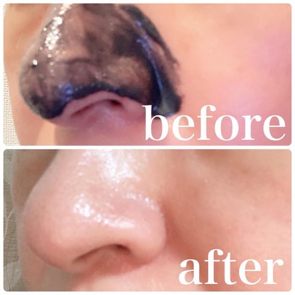 ソフィーナ iP ポア クリアリング ジェル ウォッシュ/SOFINA iP/その他洗顔料を使ったクチコミ(4枚目)