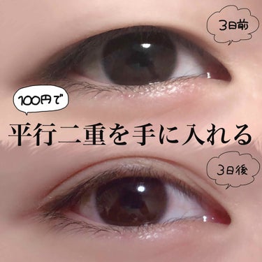 整形なし 奥二重から二重にする方法 アイプチ テープ おすすめアイテムもpick Up Lips 整形なし 奥二重から二重にする方法 アイプチ テープ おすすめアイテムもpick Up Lips