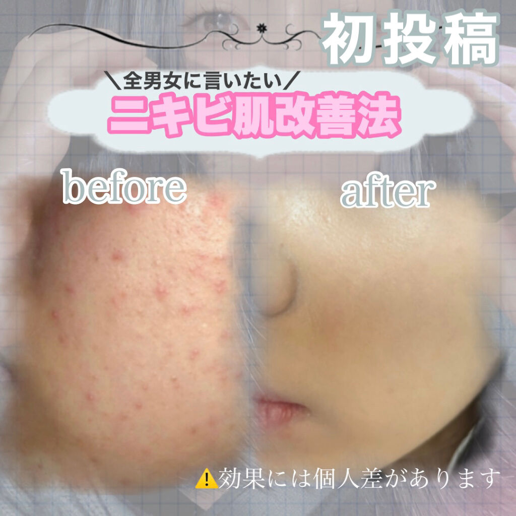 ソフティモ 薬用ホワイト クレンジングウォッシュ/ソフティモ/洗顔フォームを使ったクチコミ（1枚目）