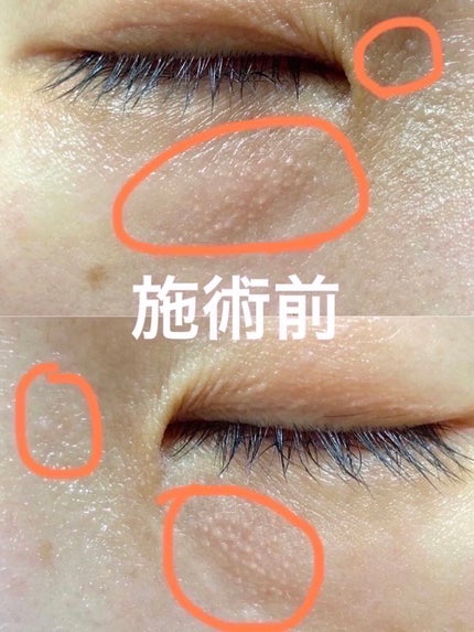 を使ったクチコミ(2枚目)