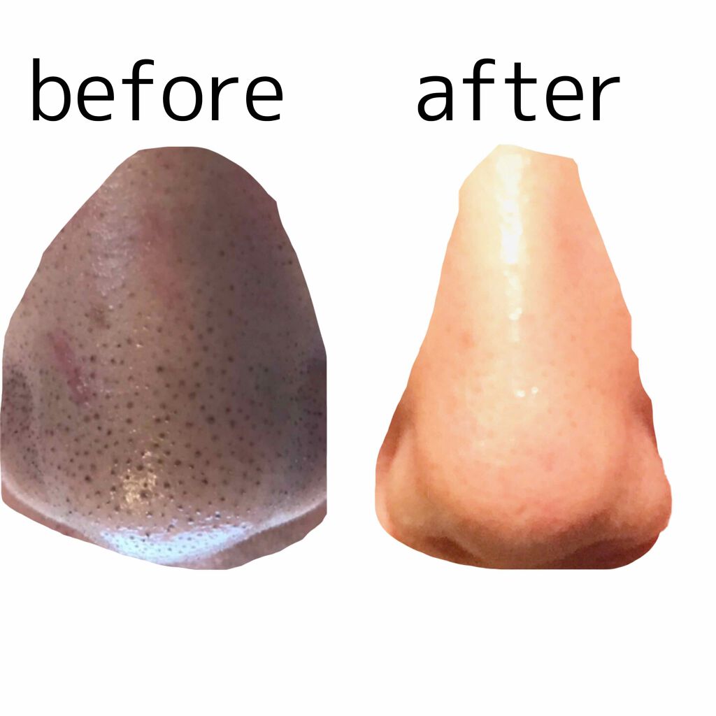 薬用ホワイト 洗顔フォーム/ソフティモ/洗顔フォームを使ったクチコミ(1枚目)