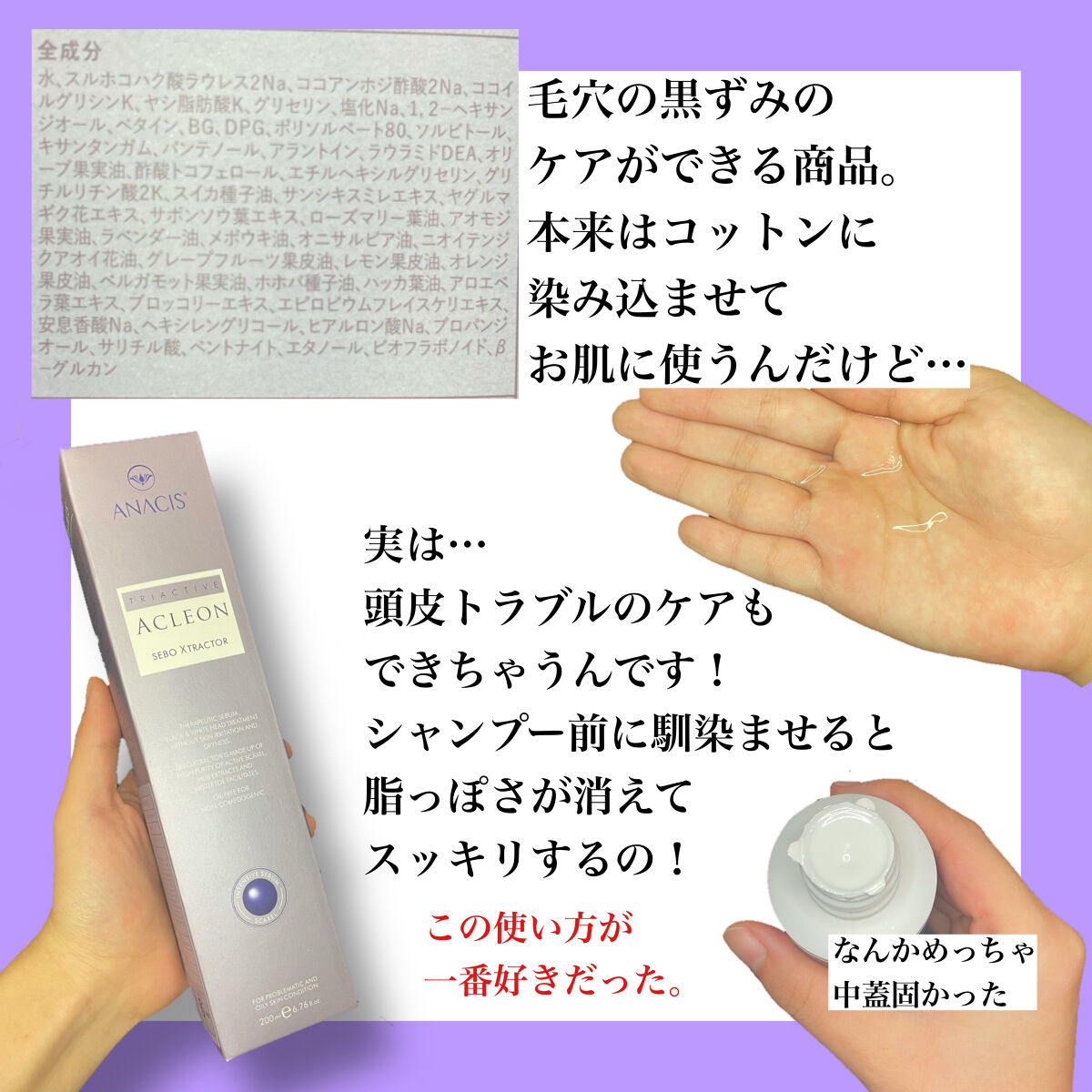 アクレオンセボエクストラクター/ANACIS/その他スキンケアを使ったクチコミ（2枚目）