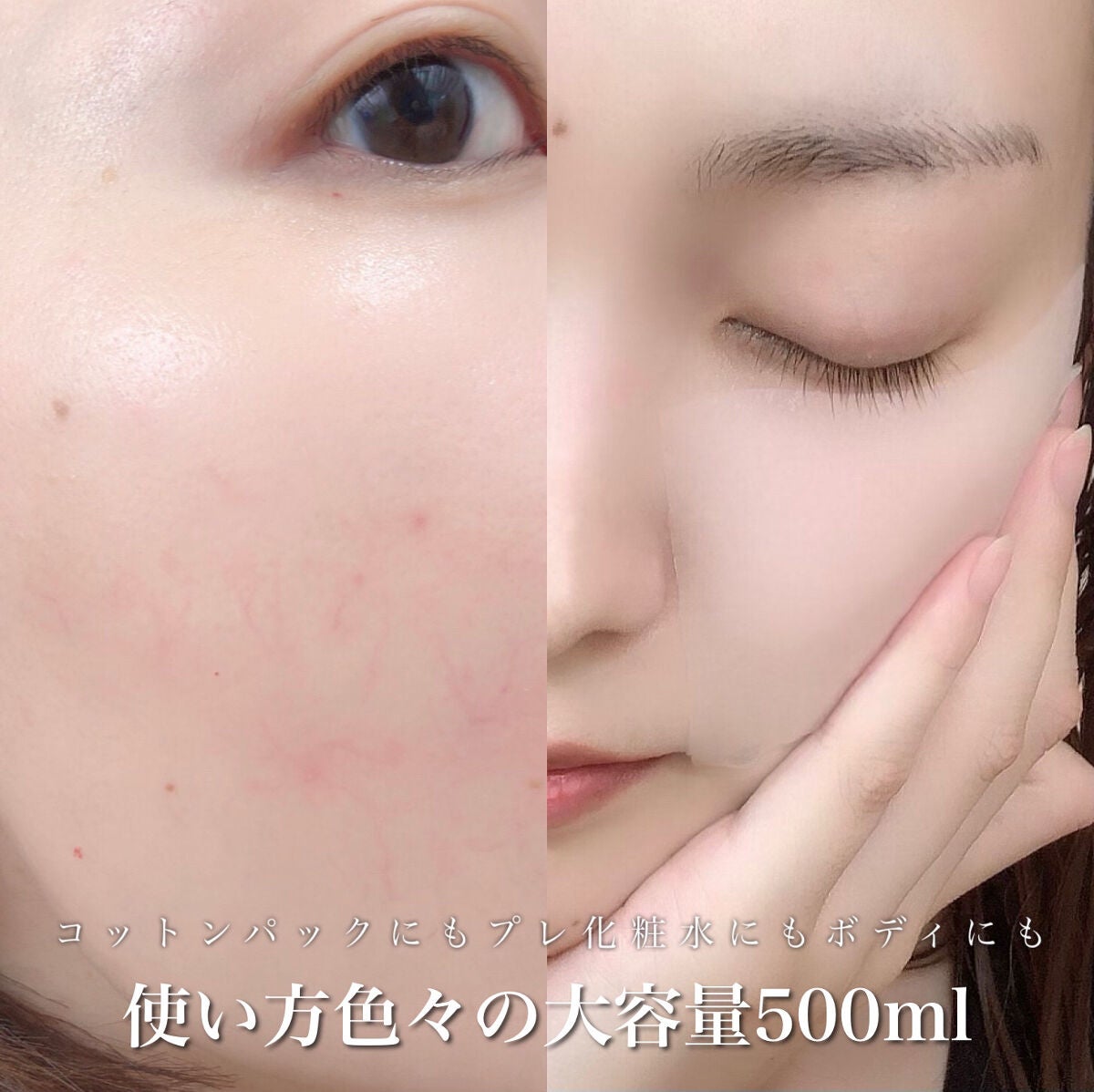 ハトムギ化粧水(ナチュリエ スキンコンディショナー R )/ナチュリエ/化粧水を使ったクチコミ(7枚目)