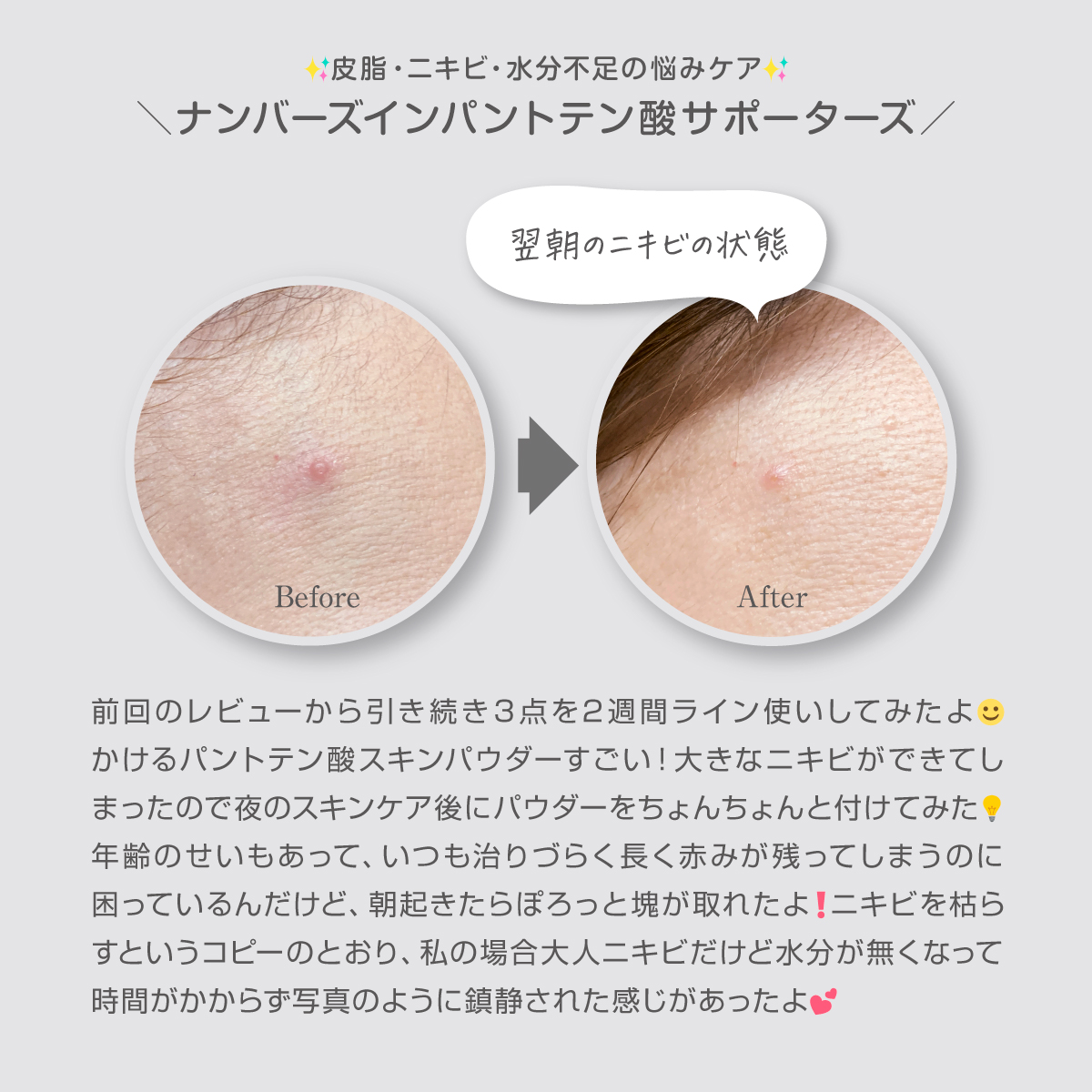 1番 ガルバニックパントテン酸スージングセラム/numbuzin/美容液を使ったクチコミ（3枚目）