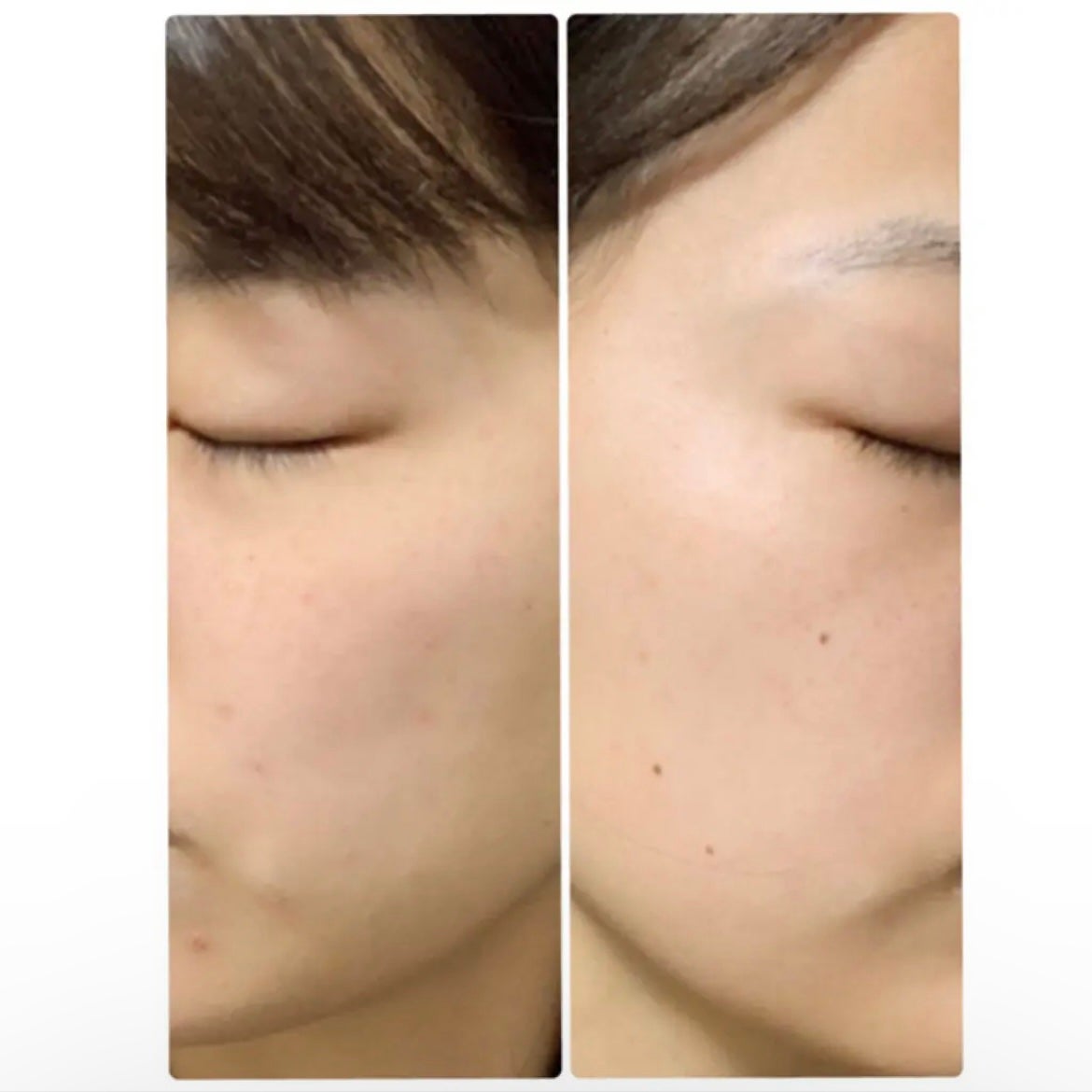 ちょむ@フォロバ100 on LIPS 「こんにちは🌞ちょむです😆今回はレビューというか、体を張った私の..」(3枚目)