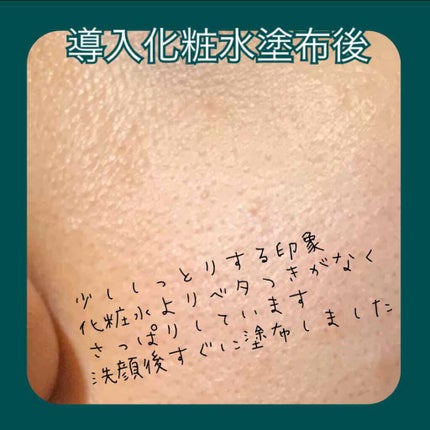導入化粧液/無印良品/ブースター・導入液を使ったクチコミ(2枚目)