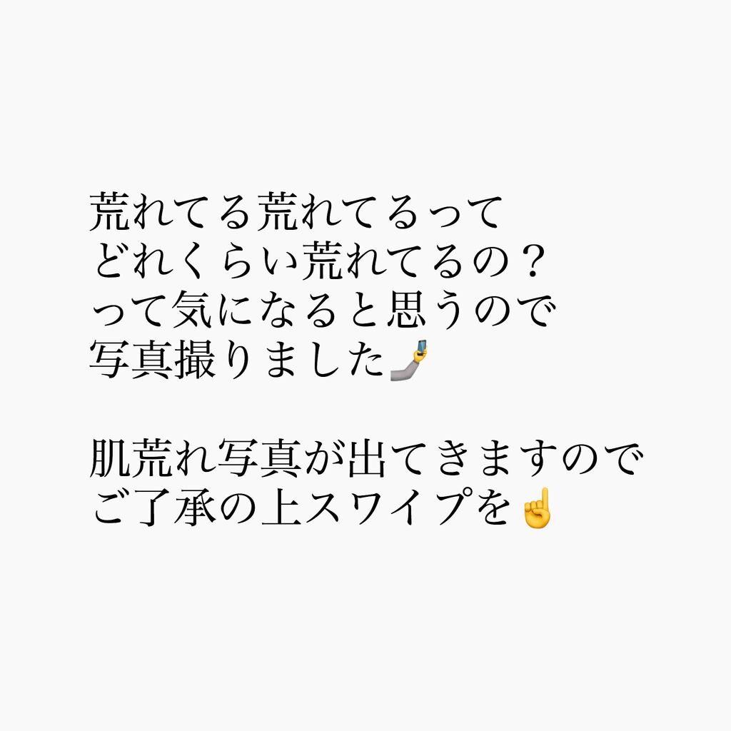 nayo. on LIPS 「私の肌これくらい荒れてます/CNPのピーリングブースターのレビ..」(1枚目)