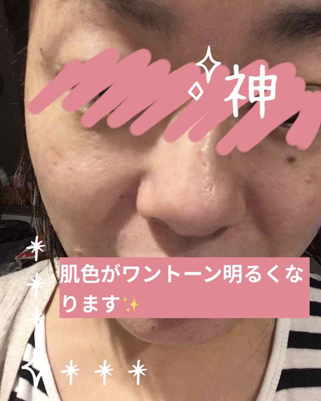 いいじゃんガスール石鹸/イーキューブ/洗顔石鹸を使ったクチコミ（3枚目）