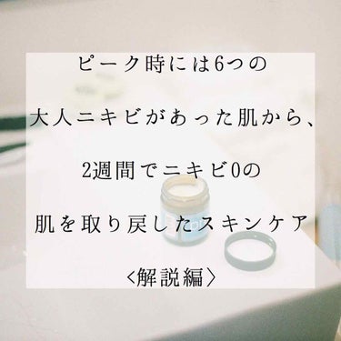 ここでは、どうしてあのスキンケアに行き着いたのか、大人ニキビをなくすのに必要なことなどを書いていきます。
※前投稿の解説編です。


スキンケアで大事なのは「落とす・補水・保水」です(特に落とす)。
ま