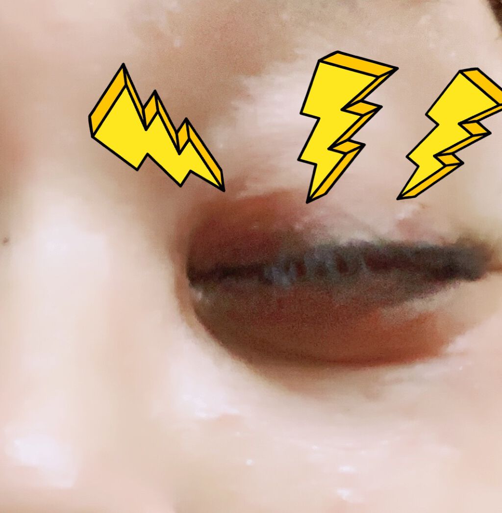 リサ・ラーソン♡クッションファンデマニア on LIPS 「ワタクシめ遺伝的に#イボ出来やすい体質にて↑↑イボは#美白ケア..」(1枚目)