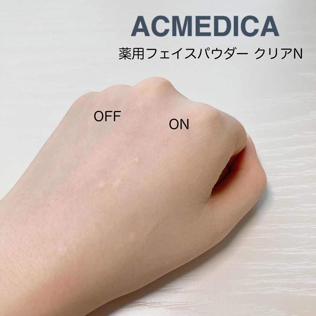 アクメディカ 薬用 フェイスパウダー クリア N/ナリスアップ/プレストパウダーを使ったクチコミ(2枚目)