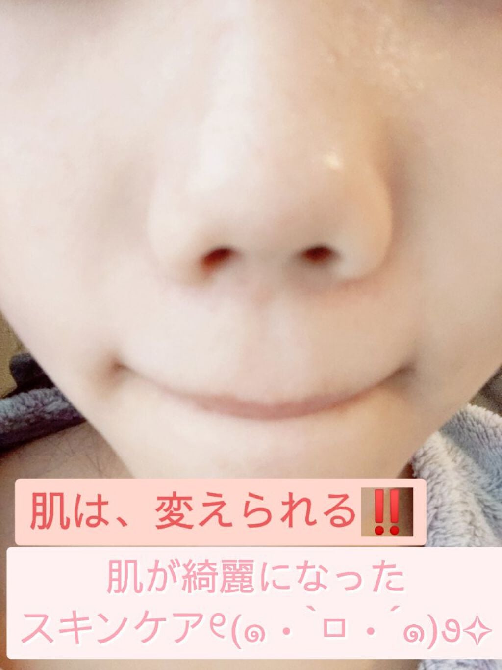 ハトムギ保湿ジェル(ナチュリエ スキンコンディショニングジェル)/ナチュリエ/美容液を使ったクチコミ(1枚目)