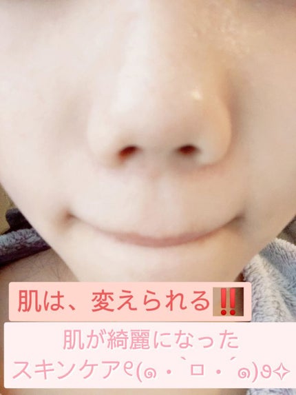 ハトムギ保湿ジェル(ナチュリエ スキンコンディショニングジェル)/ナチュリエ/美容液を使ったクチコミ(1枚目)