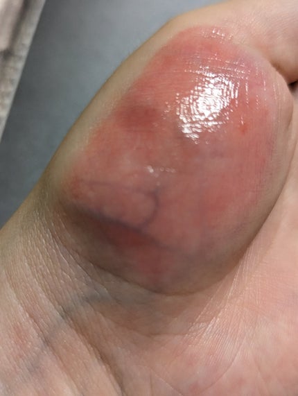 フルーティーリップジャム/dasique/リップバームを使ったクチコミ(4枚目)