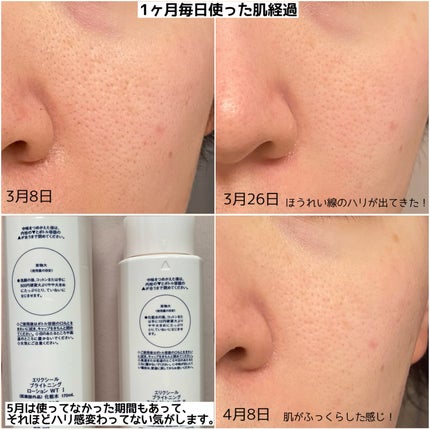 ブライトニング ローション WT Ⅱ/エリクシール/化粧水を使ったクチコミ(4枚目)