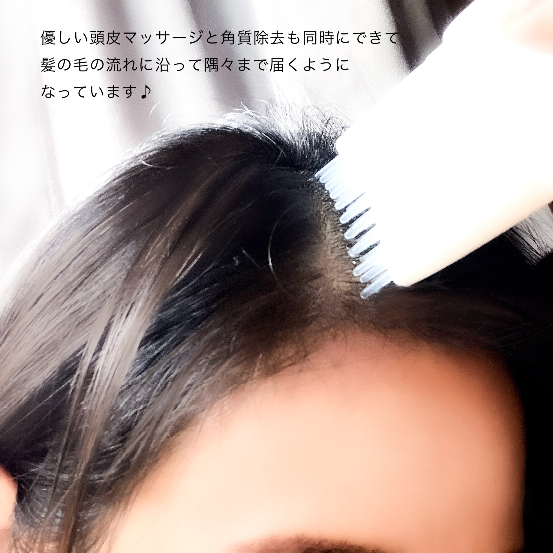 グローターン 100ml/リリーイブ/頭皮ローションを使ったクチコミ（3枚目）