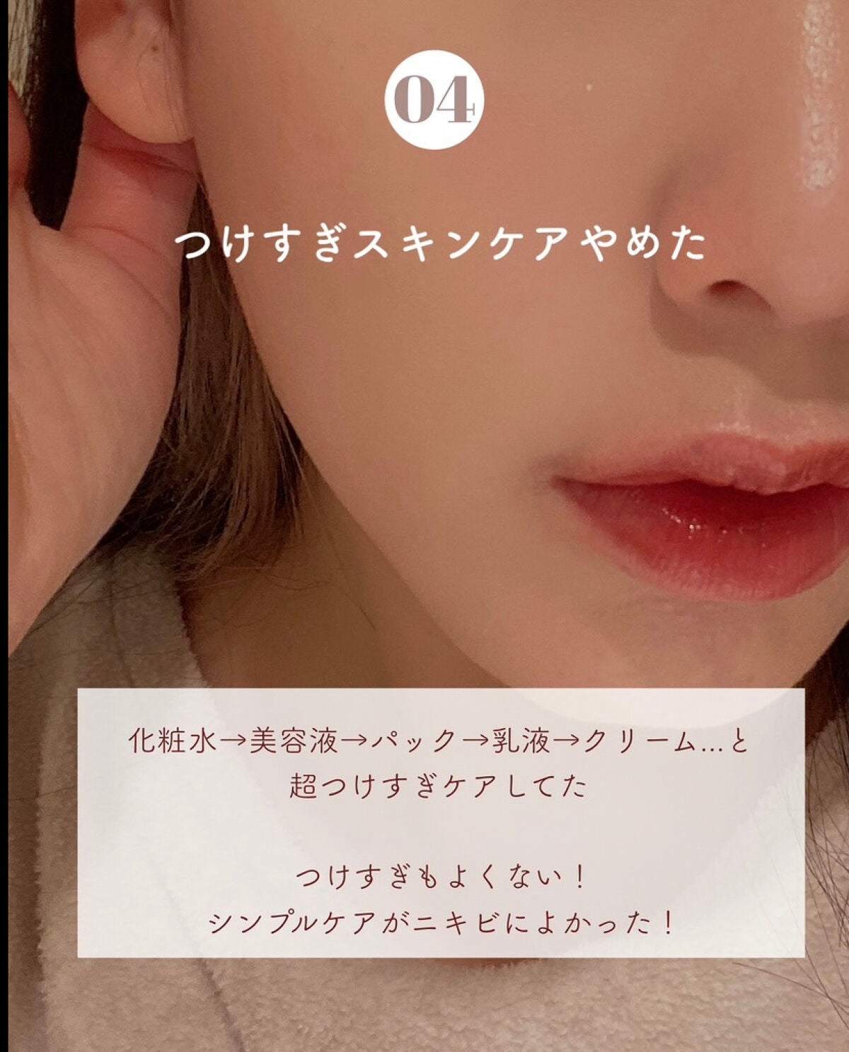 セラミドスキンケア 薬用アクネVCローション/エトヴォス/化粧水を使ったクチコミ(5枚目)