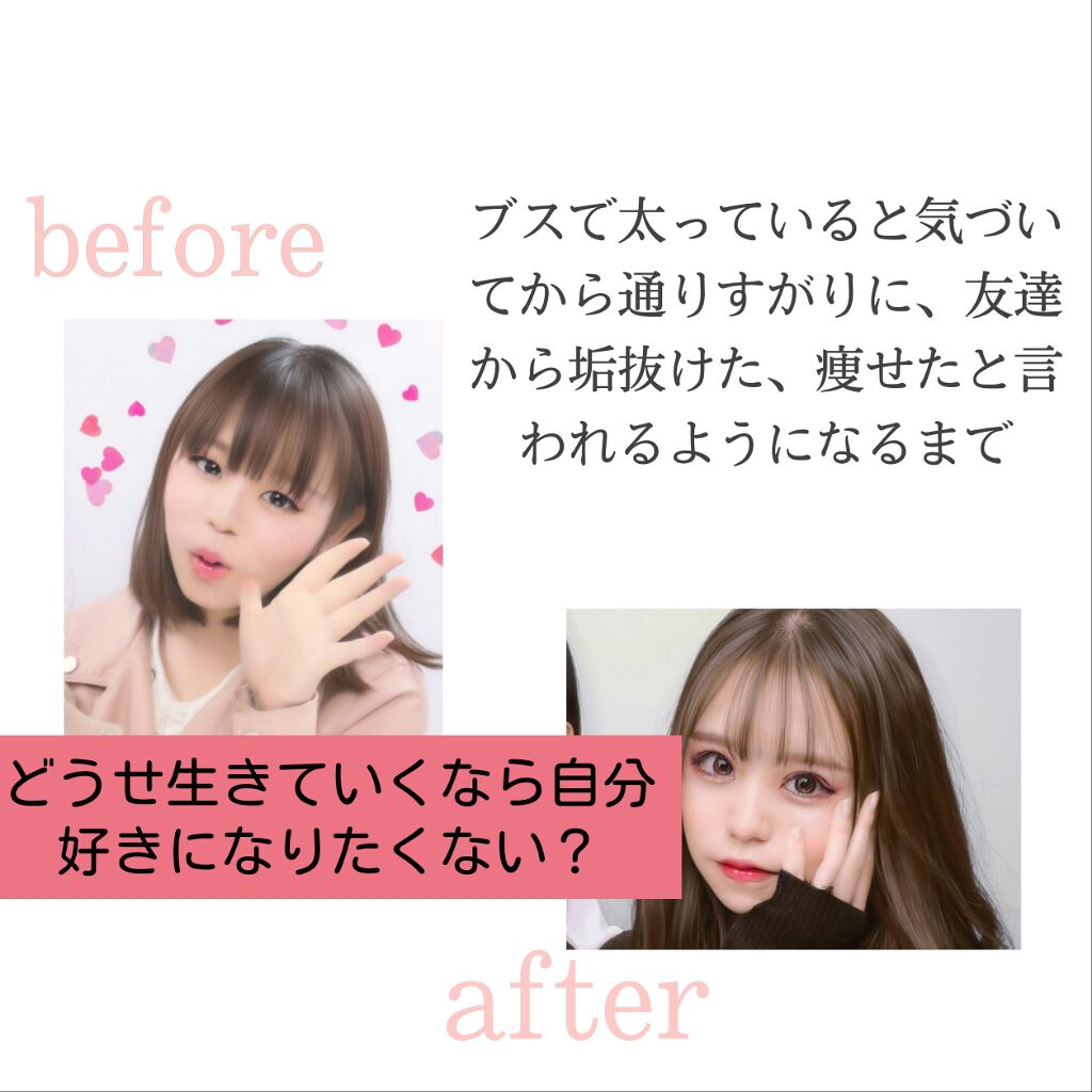 オードムーゲ 薬用ローション(ふきとり化粧水)/オードムーゲ/拭き取り化粧水を使ったクチコミ(1枚目)