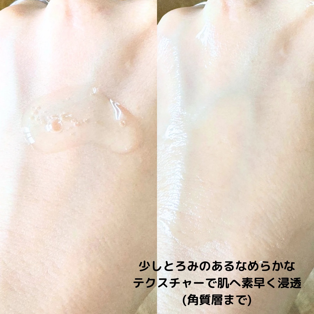 プレミアム高浸透発酵エッセンスセラム/NARTH/美容液を使ったクチコミ（3枚目）