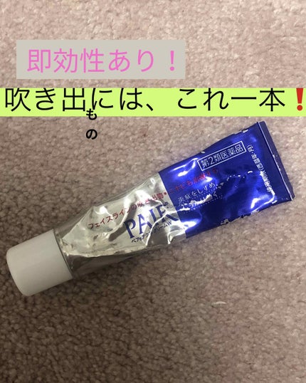 ペアアクネクリームW(医薬品)/ペア/その他を使ったクチコミ(1枚目)