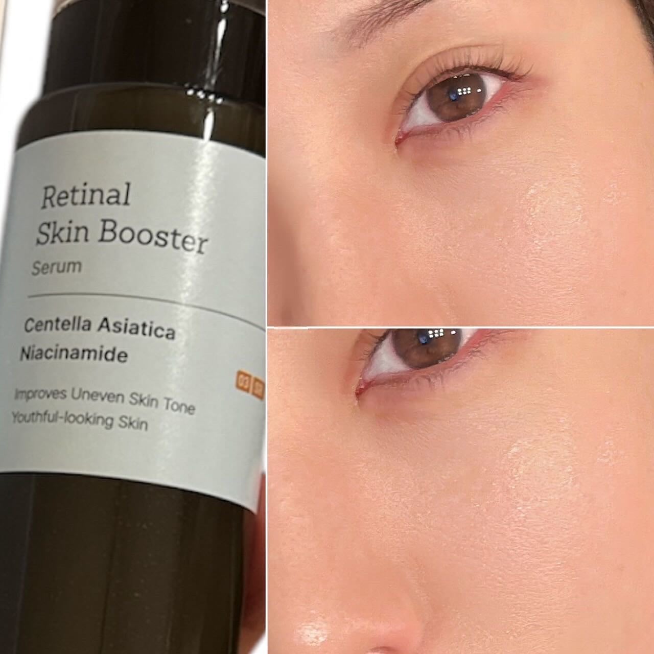 レチナールスキンブースターセラム15mL/MEDITHERAPY/ブースター・導入液を使ったクチコミ(2枚目)